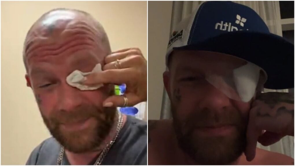 Ivan Moody (5FDP) se lesiona con un láser en directo